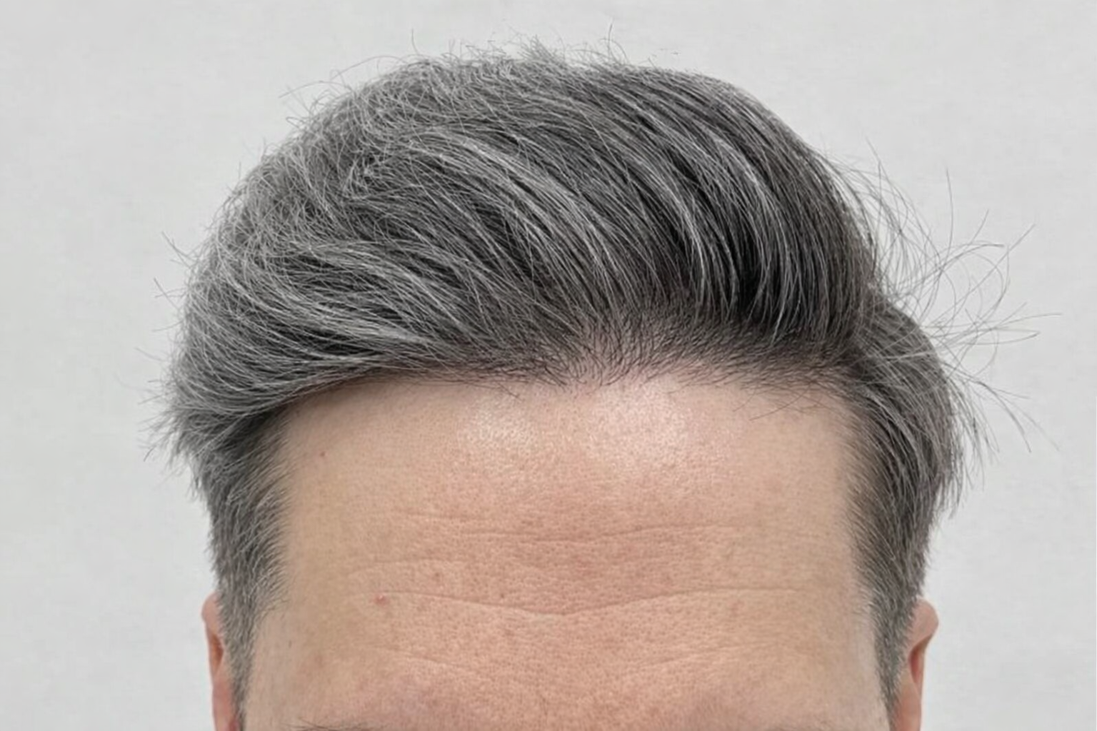 Μετά τη μεταμόσχευση