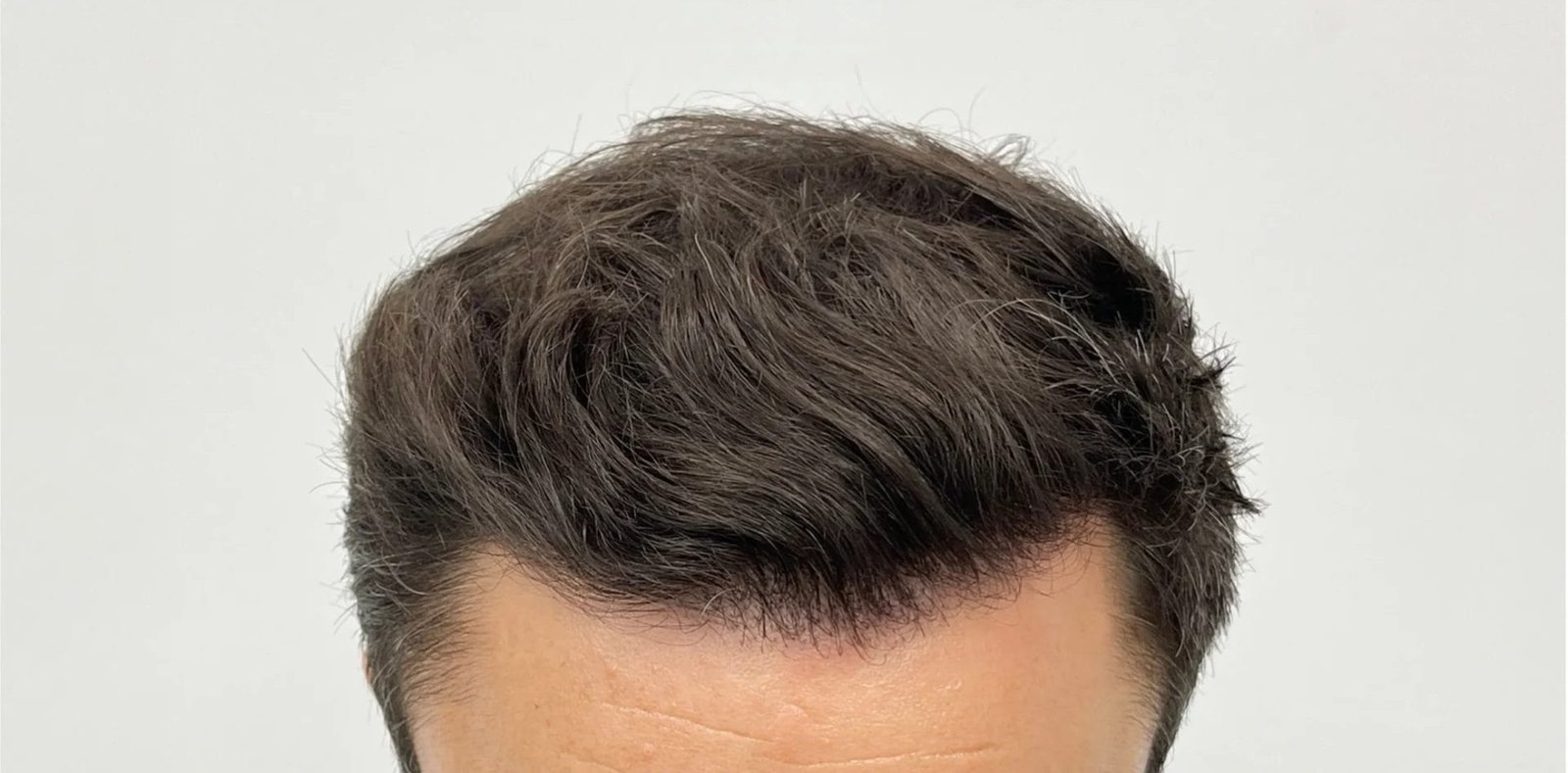 Μετά τη μεταμόσχευση